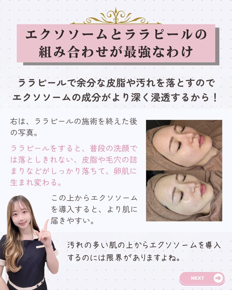 ブログ